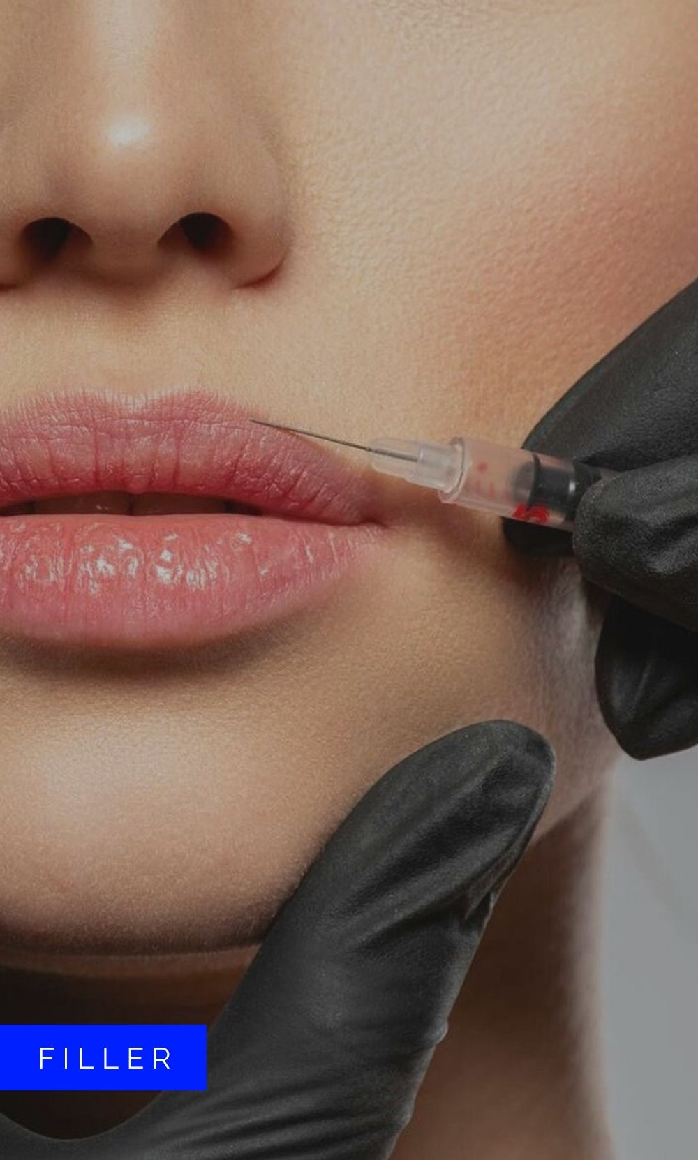DERMA FILLERS