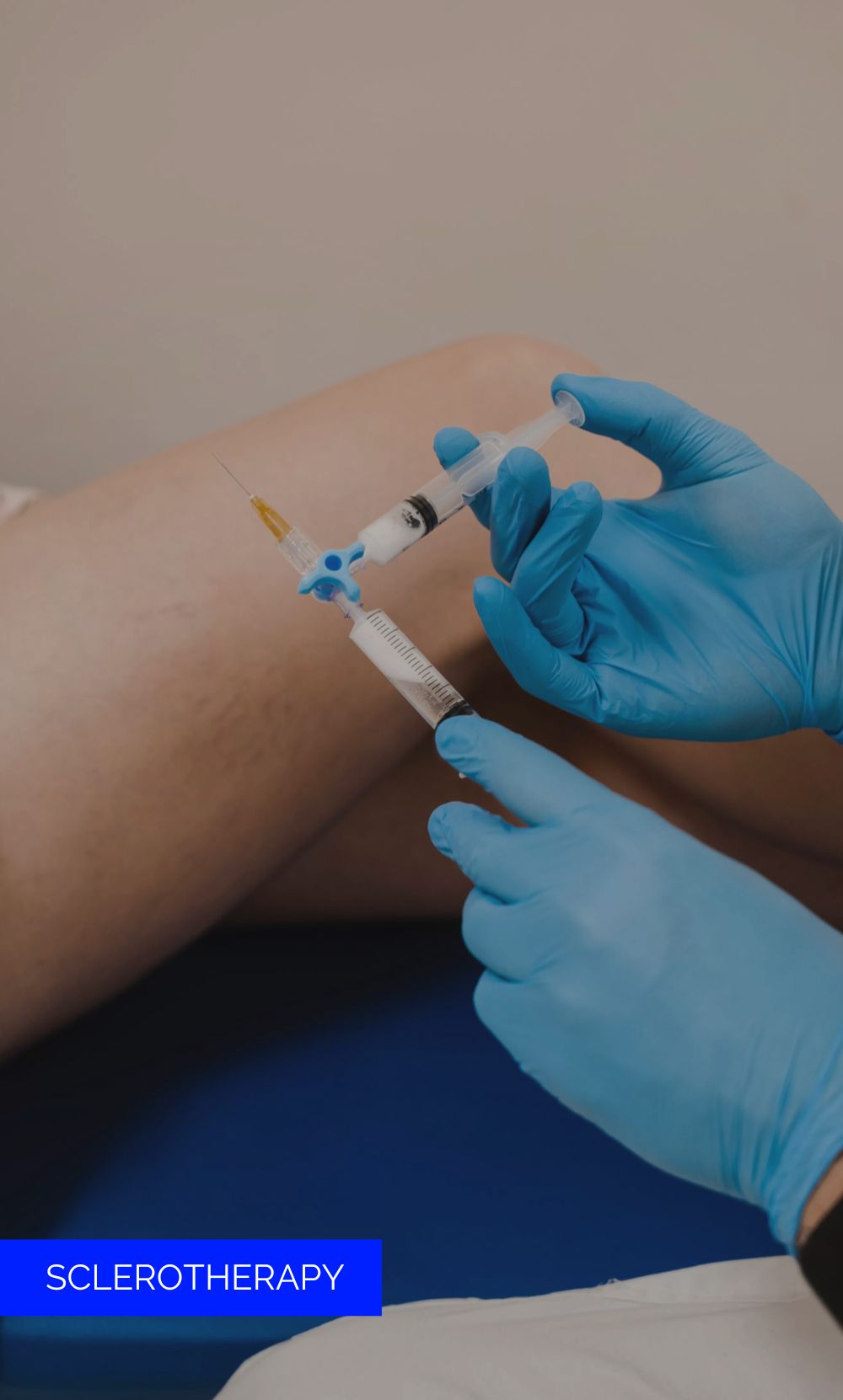 SCLEROTHERAPY